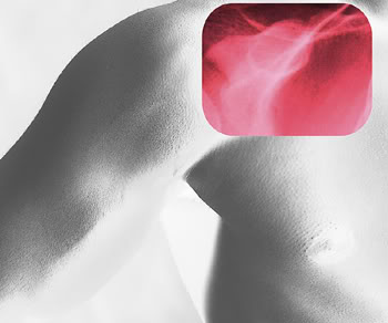 blend of picture and Xray of a shoulder